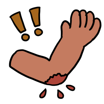 an arm with a generic bleeding injury at the elbow and two orange exclamation marks to the viewers top left.